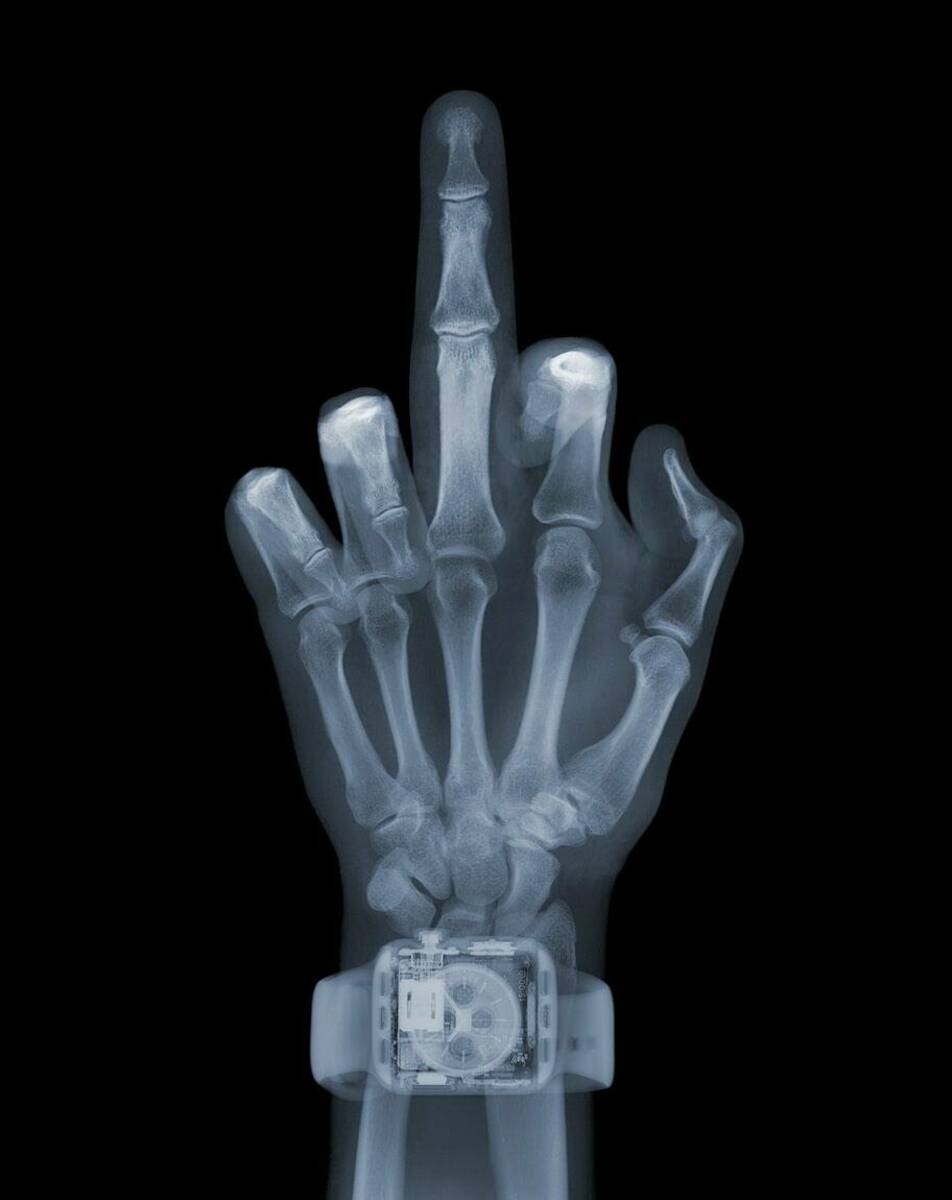 The Finger with Watch